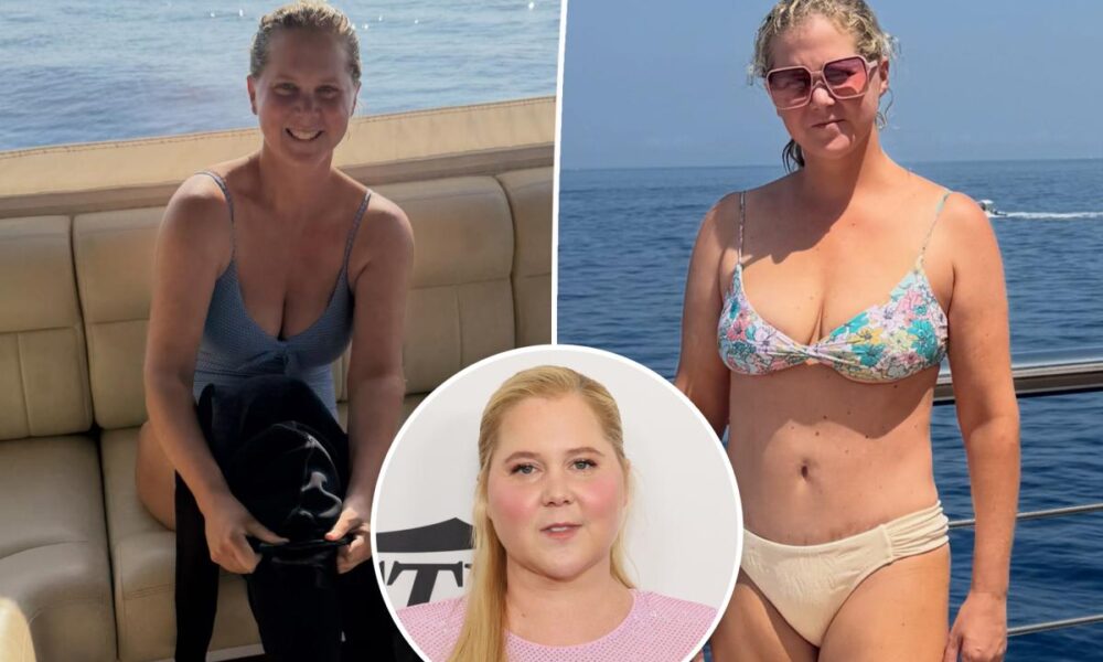 Bikini-clad Amy Schumer shows off dramatic weight loss in new unfiltered photos