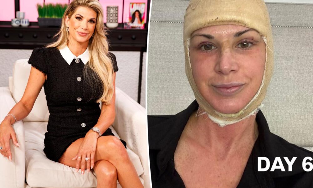 ‘RHOC’ alum Alexis Bellino treats herself to facelift ahead of 50th birthday