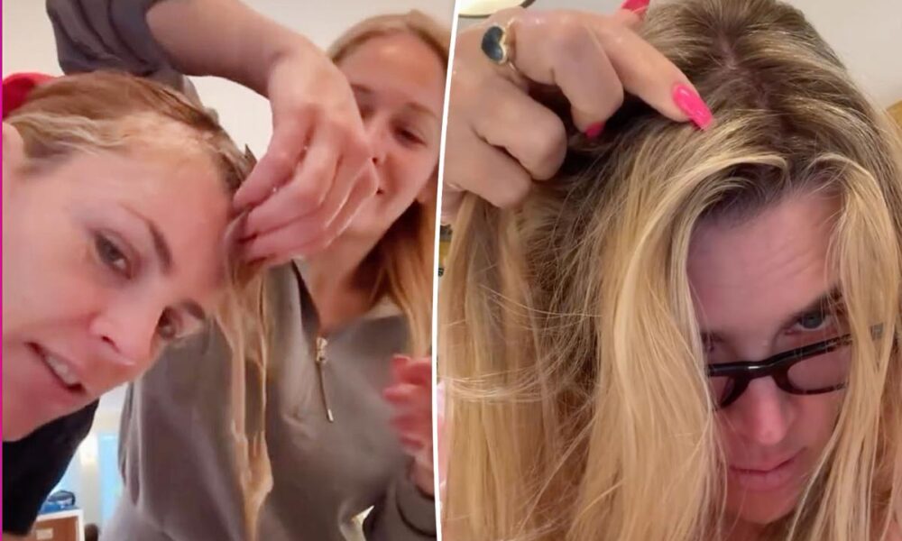 Busy Philipps shares behind-the-scenes photos from ‘f–king crazy’ brain surgery journey