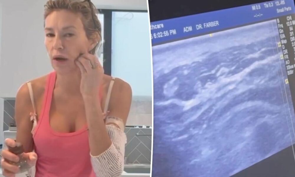 Brandi Glanville saw ‘something alive’ and ‘moving’ in her face in horrifying ultrasound