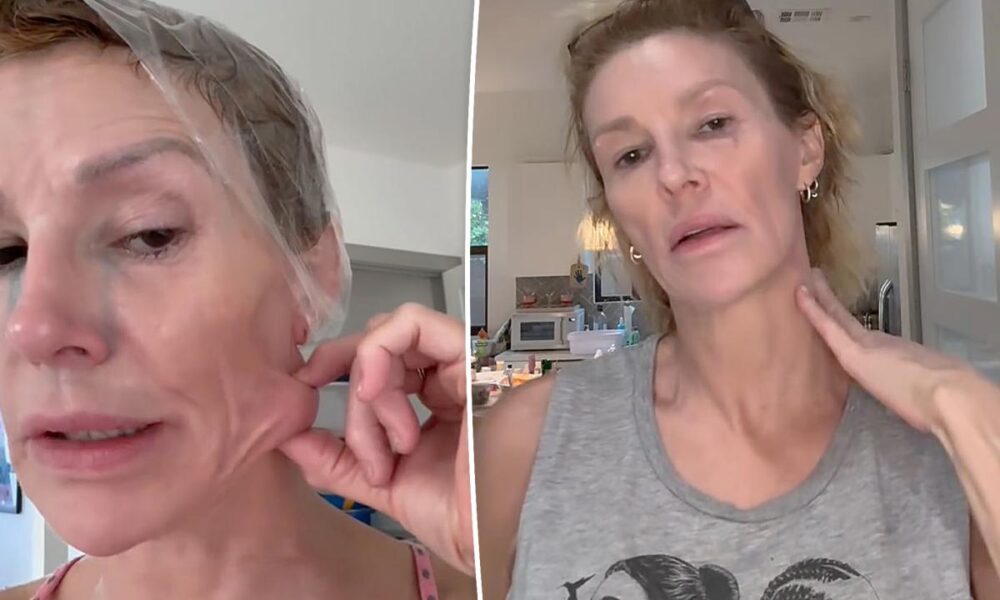 Brandi Glanville reveals slew of diagnoses as she prepares to have ‘fungal ball’ removed from her face