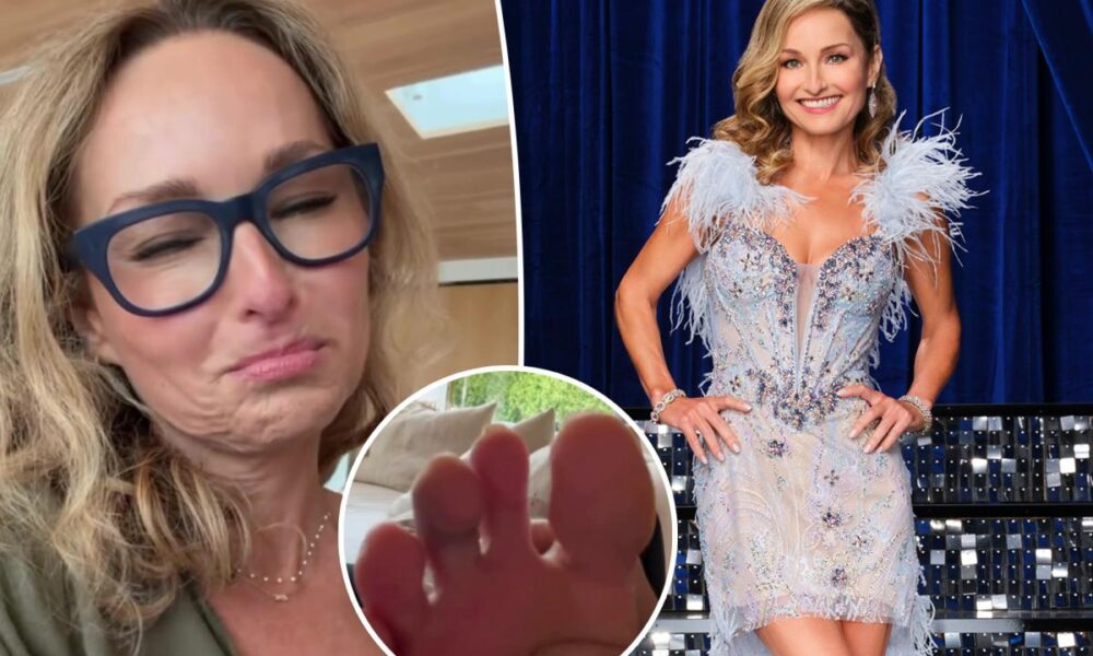 Giada De Laurentiis reveals gnarly injury ahead of ‘Dancing With the Stars’ premiere