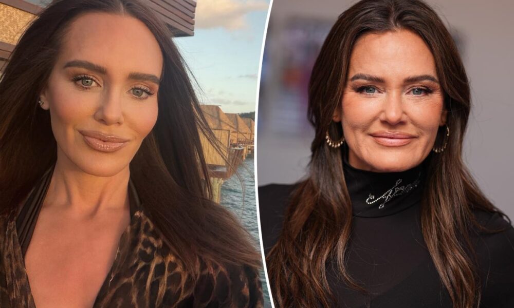 Meredith Marks shares details on her facelift