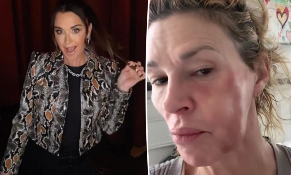 Brandi Glanville reacts to Kyle Richards’ GoFundMe donation