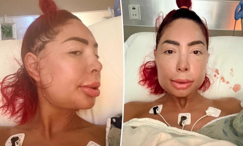Farrah Abraham unrecognizable after jaw surgery leaves face severely swollen
