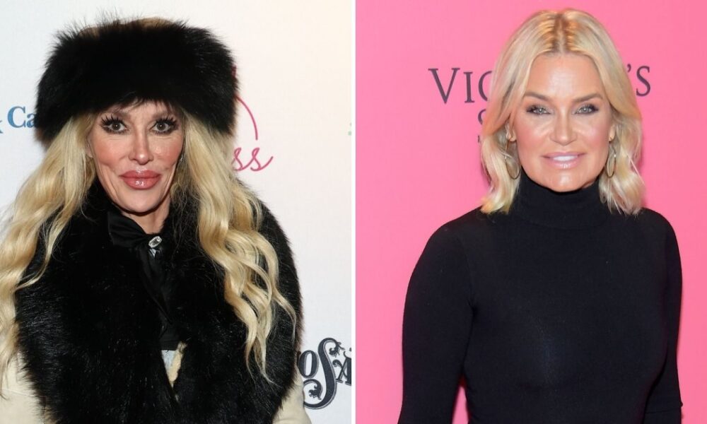 Brandi Glanville Praises ‘RHOBH’ Costar Yolanda Hadid’s Support Amid Health Battle: ‘Very Helpful’