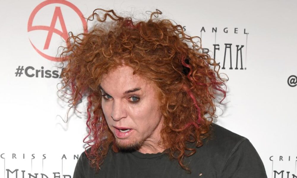 Carrot Top’s Rep Gives Update on Comedian’s Condition Amid Hospitalization After Alleged Suicide Attempt
