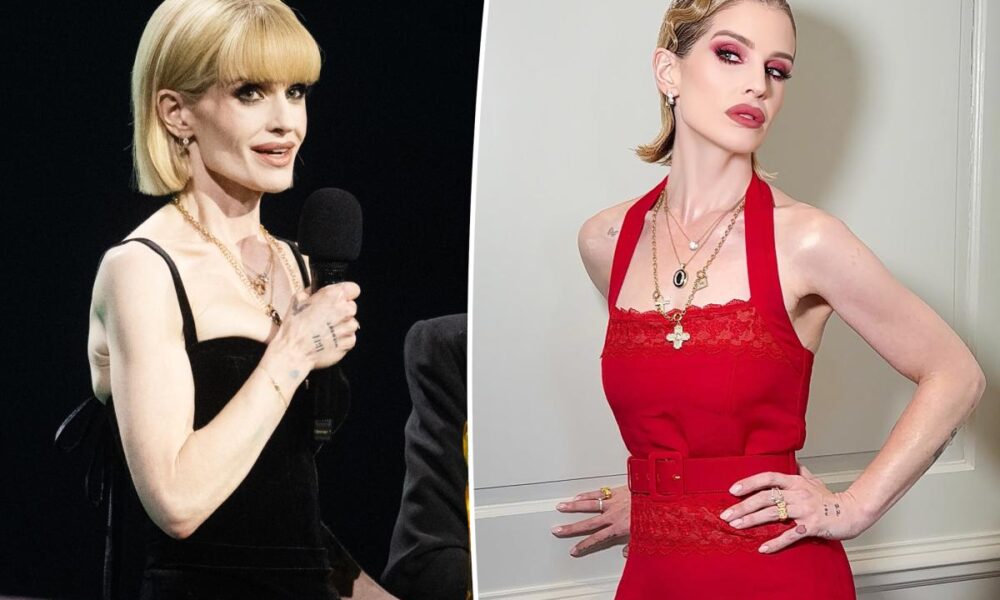 ‘Sick’ Kelly Osbourne details ‘slow process’ of recovery as she addresses body-shaming
